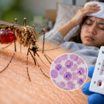 Waspada Malaria! Kenali Gejalanya Sebelum Terlambat